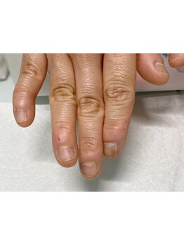 爪の悩みを解消できる（ケア含む）