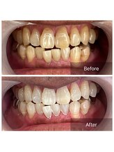 ライエ(Raie)/Before After