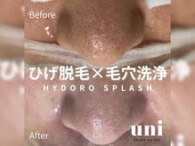 サロン ド ユニ(SALON DE UNI)の雰囲気（毛穴洗浄で頑固な黒ずみ汚れ撃退！脱毛との組み合わせもおすすめ）