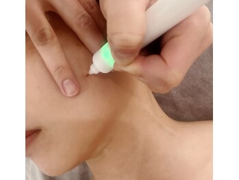 アグライア(Aglaea)/シミケア施術