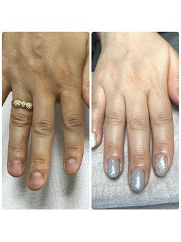 エルナ(elna)/肌から綺麗に!