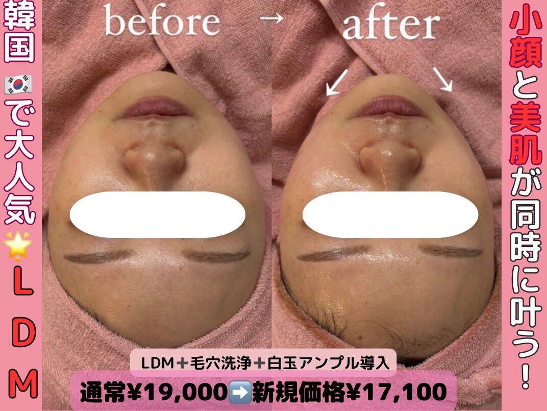 E&N エンクリニカルラボ LED美顔マスク