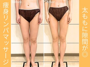 ミモザ鍼サロン(mimoza鍼サロン)/下半身のリンパケアで足が細く♪