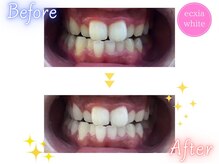 エクシアホワイト 宮崎末広店/