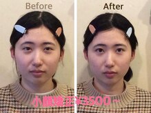 健幸堂 本店の雰囲気（人気メニュー＊小顔矯正＊）