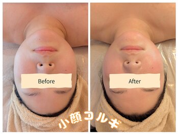 フィル 名駅店(fil)/名古屋店小顔コルギなら