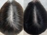 【薄い毛、髪質改善】スカルプケア プレミアム 55,000→33,000