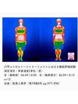 フルール エンビロン(フルール ENVIRON)/健康の秘訣体温を高く保つ！