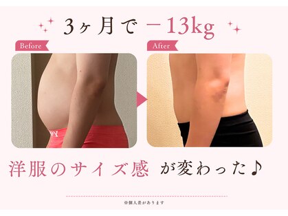ヨサパーク トゥインクル(YOSAPARK twinkle)の写真