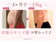 ヨサパーク トゥインクル(YOSAPARK twinkle)の写真