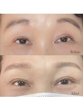 ピノ(pino)/目元のお手入れで印象チェンジ