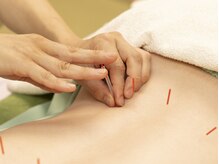 泰山はり灸院/腰痛/鍼灸