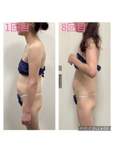 リオンズ 茨城ミスターマックス取手店/痩身8回40代