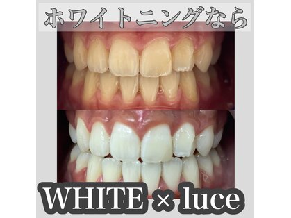 ホワイト ルシェ(WHITE×luce)の写真