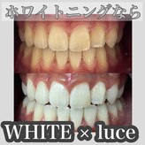 ホワイト ルシェ(WHITE×luce)