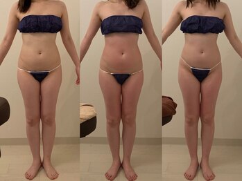 ラヴィエ ベル(La vie est belle)/セルライトゼロ2