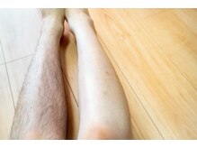 ゴールドプラス 桑名店(GOLD PLUS)/脱毛