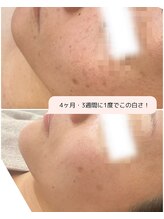 スカーラ(Sukhalah)/しみ・くすみケアに！