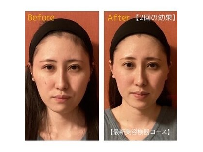 ロイヤリティ(ROYALTY)の写真
