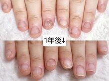 グレースレディ 大阪店/深爪/自爪育成/フィルイン
