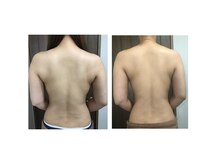 エステサロン オージャス(Ojas)の雰囲気（最速で結果の出ると口コミ大好評のブライダルエステ♪）