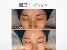 アンドミルル(and Milulu)/【艶玉フェイシャル】