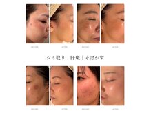 ラシェプリズ(LACHER PRISE)