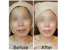 ミミ トータルケア(mimi Total care)