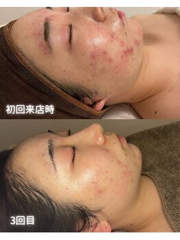 リルビー(Lilby)の写真/「何をしても変わらなかった」方へ。ぜひ当サロンで“本気の変化”を実感しませんか？