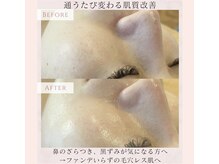 プレジール(Plaisir)の雰囲気（毛穴ケアもお任せ下さい。黒ずみ/ザラつき/ツヤ肌/フェイシャル）