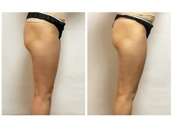 ザ ボディメイク(THE BODY MAKE)/太ももスペシャルMENU！！