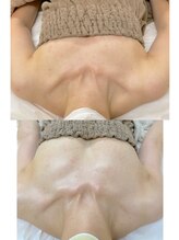 ワイサロン(Y salon)/40代/産後バストアップ/4ヶ月