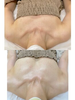 ワイサロン(Y salon)/40代/産後バストアップ/4ヶ月