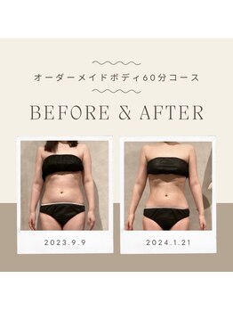ラシク 北堀江店(LACHIC)/ビフォーアフター