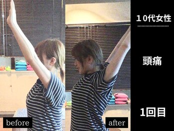 ミーツ(MEETS)/天気頭痛だと思っていたら