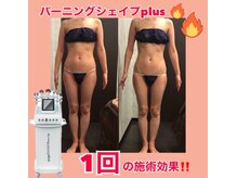 メディカルエステサロン ローズ 鯖江店(ROSE)/お腹周りもスッキリ変化☆