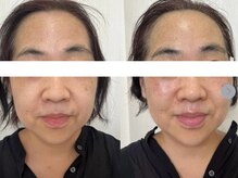 サクラ 本厚木駅前店(SAKURA)/厚木ダンスレジェンドのお手伝い