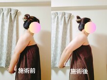 リンパサロンつむぐ/肩の可動域広がった