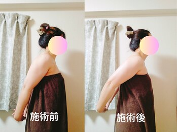 リンパサロンつむぐ/肩の可動域広がった