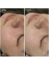 フォア(foi)/くすみ　トーンアップ