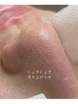 レイ エステティック 江南店(RAY ESTHETIC)/毛穴洗浄×顔脱毛
