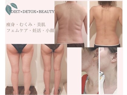 ヨサパーク ブルーチェリー(YOSA PARK Blue Cherry)の写真
