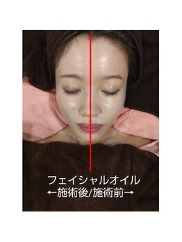 ソリーシェ鍼灸院(SORRISCE)/Before⇒After