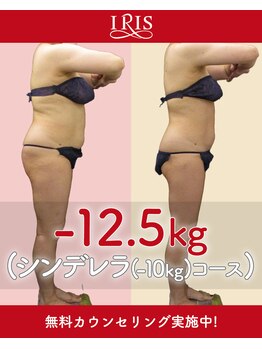 アイリス 那覇おもろまち店/ダイエットコース