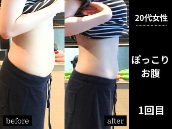 ミーツ(MEETS)/腸もみでぽっこりお腹もスッキリ