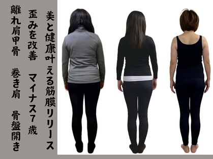 ガロシェ(galocher)の写真