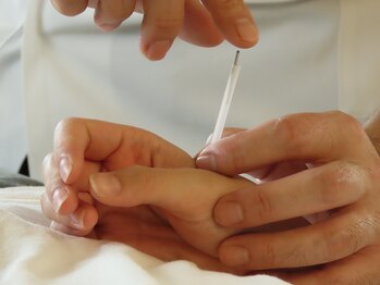 小笠原鍼灸接骨院/鍼灸［所沢/下山口］