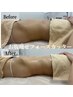 サイズダウン【お腹】脂肪燃焼&分解!ダイエットマシン&リンパマッサージ!