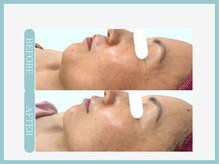 アコガレコガオ 仙台店/