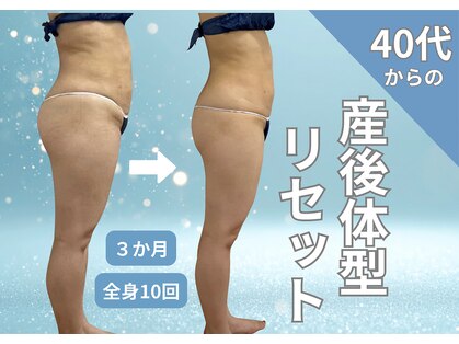 エルナ(ELUNA)の写真